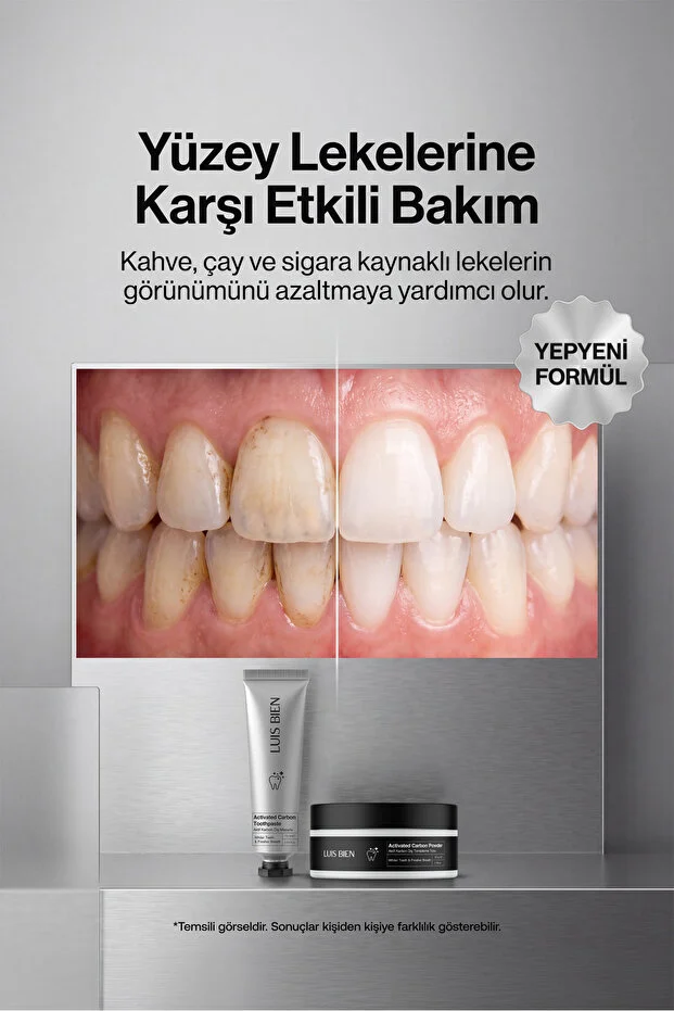 Diş Beyazlatma Seti – Aktif Karbonlu Diş Macunu + Diş Tozu, Çay Kahve Lekesi Karşıtı | Ağız Bakımı